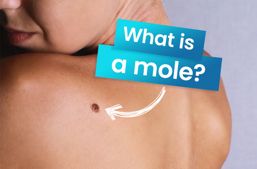 What is a mole? - 1
