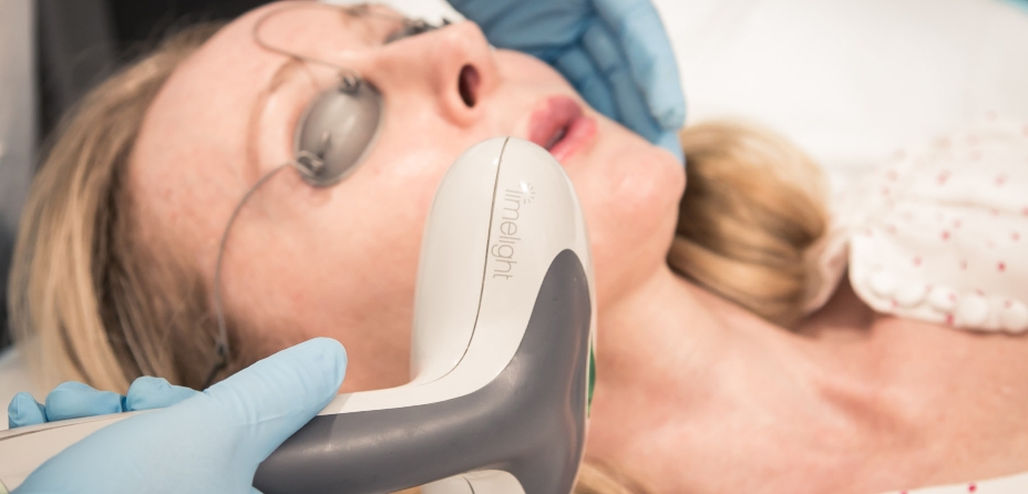 Cutera Limelight IPL 2, The DOC Clinic Melbourne